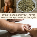 Tea for Swollen Legs: A Natural Remedy for Water Retention and Poor Circulation