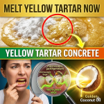 The “Cement Smile”: How to Melt Away Yellow Dental Tartar Naturally (For Pennies!)