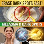 Erase Melasma & Dark Spots Fast! The 2-Ingredient “Potato Power” Pantry Mask for Porcelain Skin