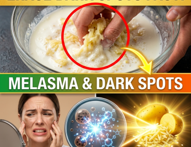 Erase Melasma & Dark Spots Fast! The 2-Ingredient “Potato Power” Pantry Mask for Porcelain Skin