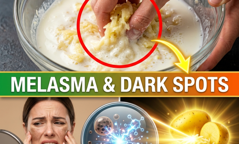Erase Melasma & Dark Spots Fast! The 2-Ingredient “Potato Power” Pantry Mask for Porcelain Skin