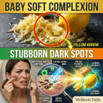 The Secret to Erasing Melasma: The Exact Timing and Golden Ratio for Flawless, Even-Toned Skin